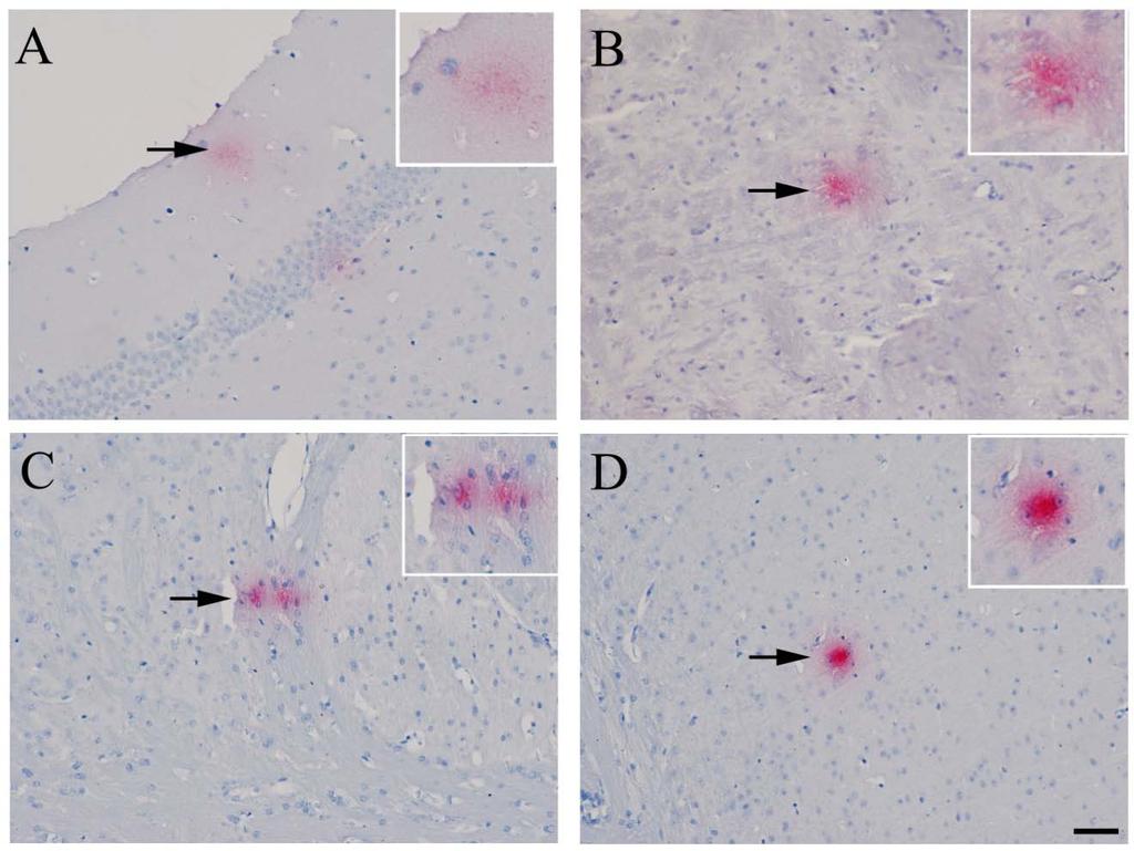 34 Figure 5. Amyloid deposits in the brains of intracranially infected mice These images represent amyloid labeling observed for experimental mice at both 7 and 14 days post-infection.