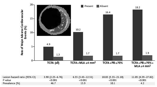 Event Rates for Lesions: Thin-Cap Fibroatheromas (TCFA) and Plaque Burden (PB) N Engl J Med 2011;364:226-235.