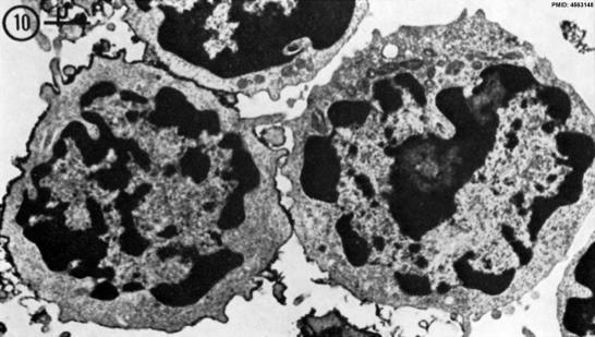 com/post/21439294463/field-emission-scanning-electron-microscope 62 B-lymphocyte (right)