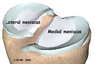 The two menisci of the knee are important for two reasons: (1) they work like a gasket to spread the force from the weight of the body over a larger area, and (2) they help the ligaments with