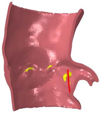 disease Mitral valve disease Coronary artery disease Valve and Aortic