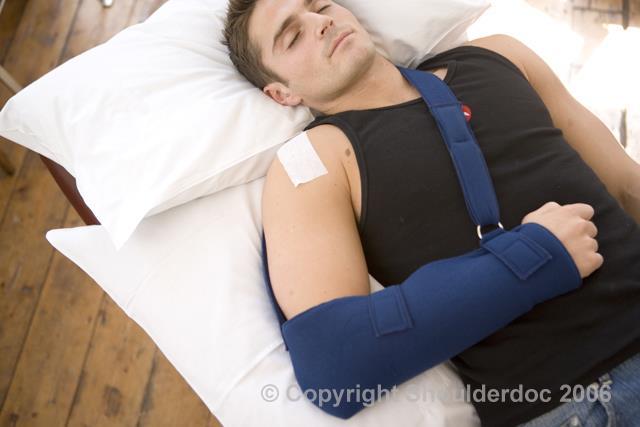 This is to protect the surgery during the early phases of healing and to make your arm more comfortable.