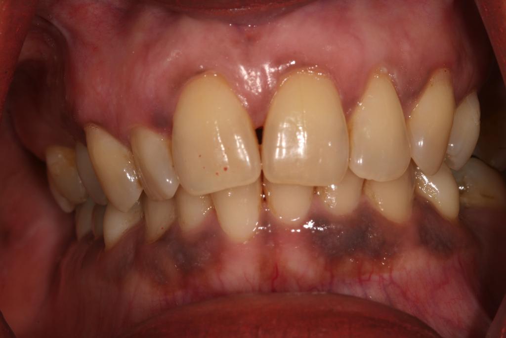 14/09/15 Why is it periodontal assessment and diagnosis important?
