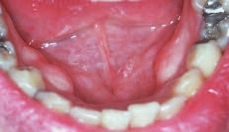 Clinical Oral medicine for the general practitioner: lumps and swellings Crispian Scully 1 This series of five papers summarises some of the most important oral medicine problems likely to be