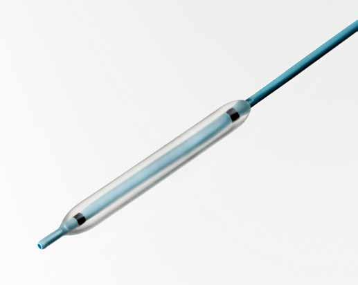 Navigator HD Ureteral Access Sheath Provides ureteral dilation and a working channel for ureteroscopes and devices during procedures.