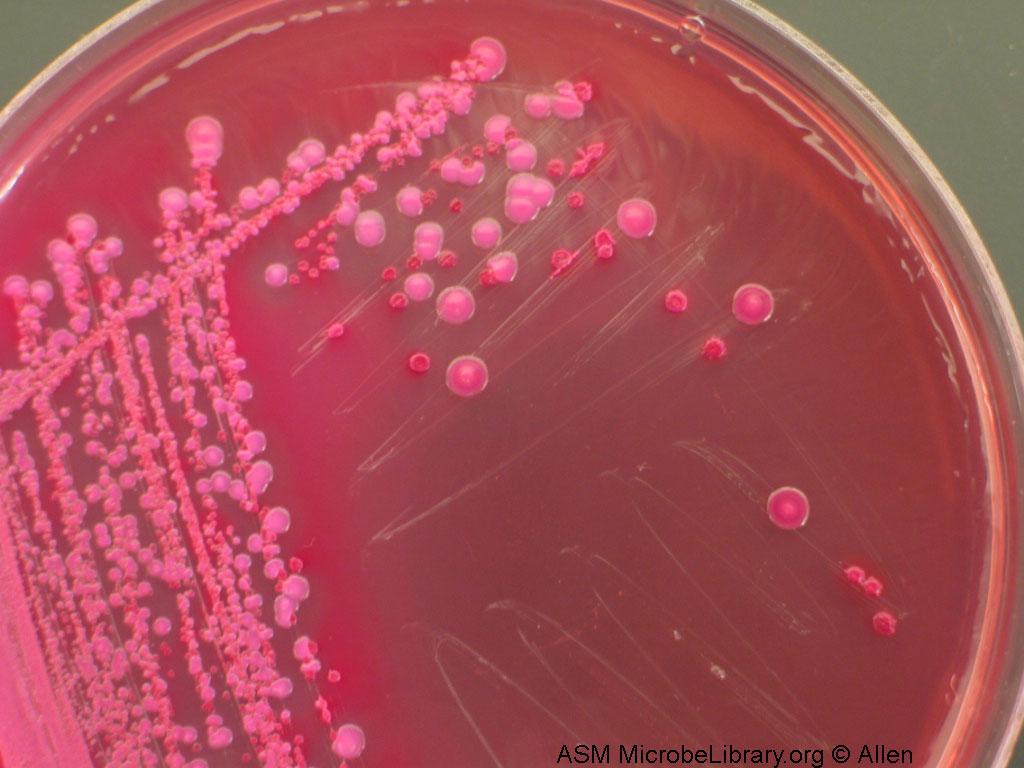 MacConkey agar plate inoculated with Escherichia coli (red) and Klebsiella