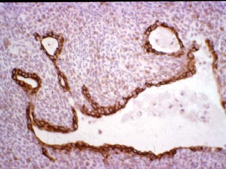 intestinal features forming glands separated