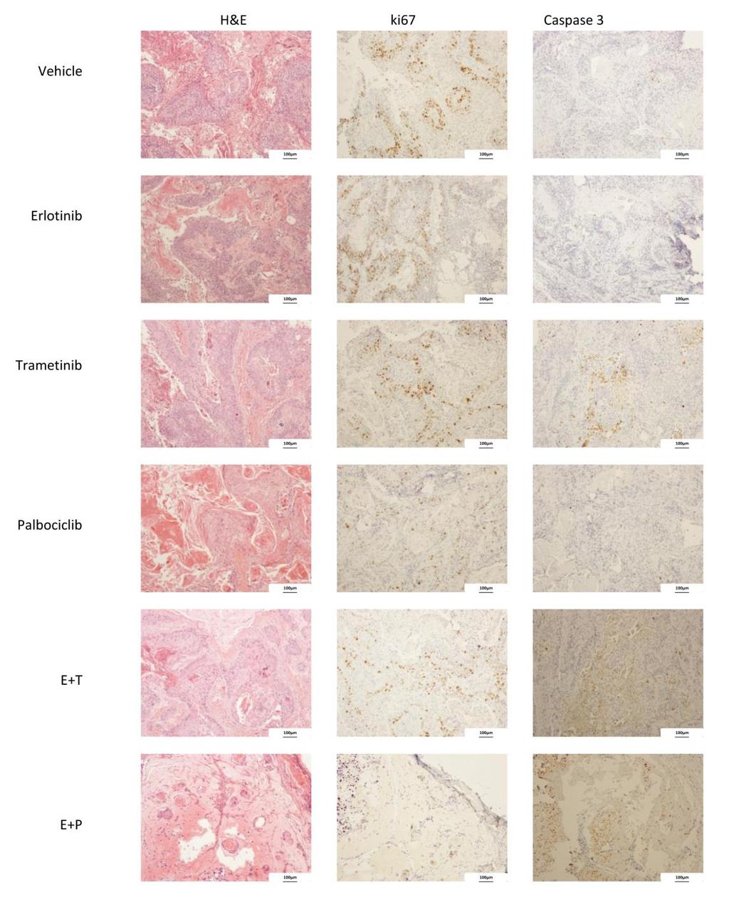 Supplementary Figure 15. Pathology analyze of OE21 xenografts tumors.