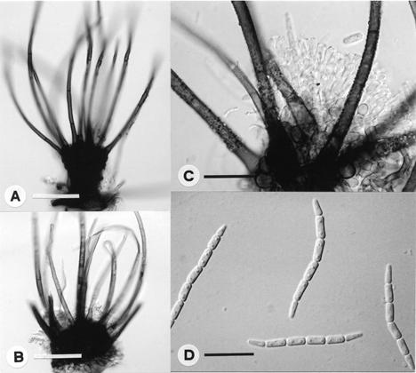 Taiwania Vol. 60, No. 3 Fig. 5. Wiesneriomyces laurinus. A: sporodochia on rotten leaf. B: branched conidiophores. C: catenulate conidia. Scale bar: A = 100 µm; B-C = 10 µm. 24.0 36.0 2.4 5.8 µm.