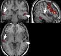 Briefly describe fmri image acquisition.