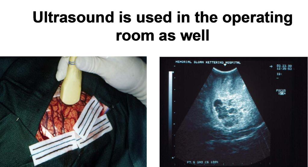 Ultrasound allows us to see