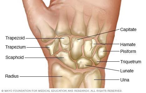 Wrist fractures - anatomy 8 carpal bones (scaphoid, lunate, triquetrum,