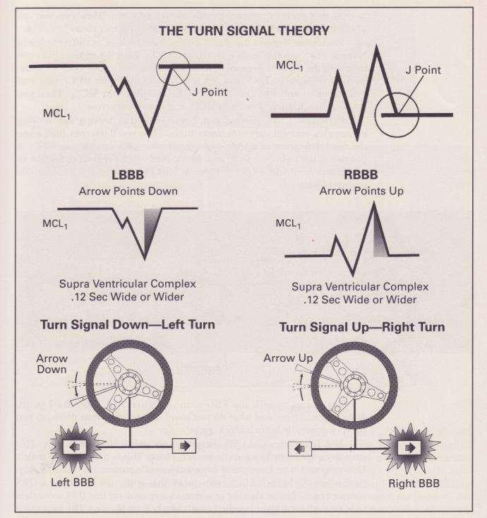 Turn signal theory - Courtesy of