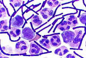 Is the Gram stain result of a