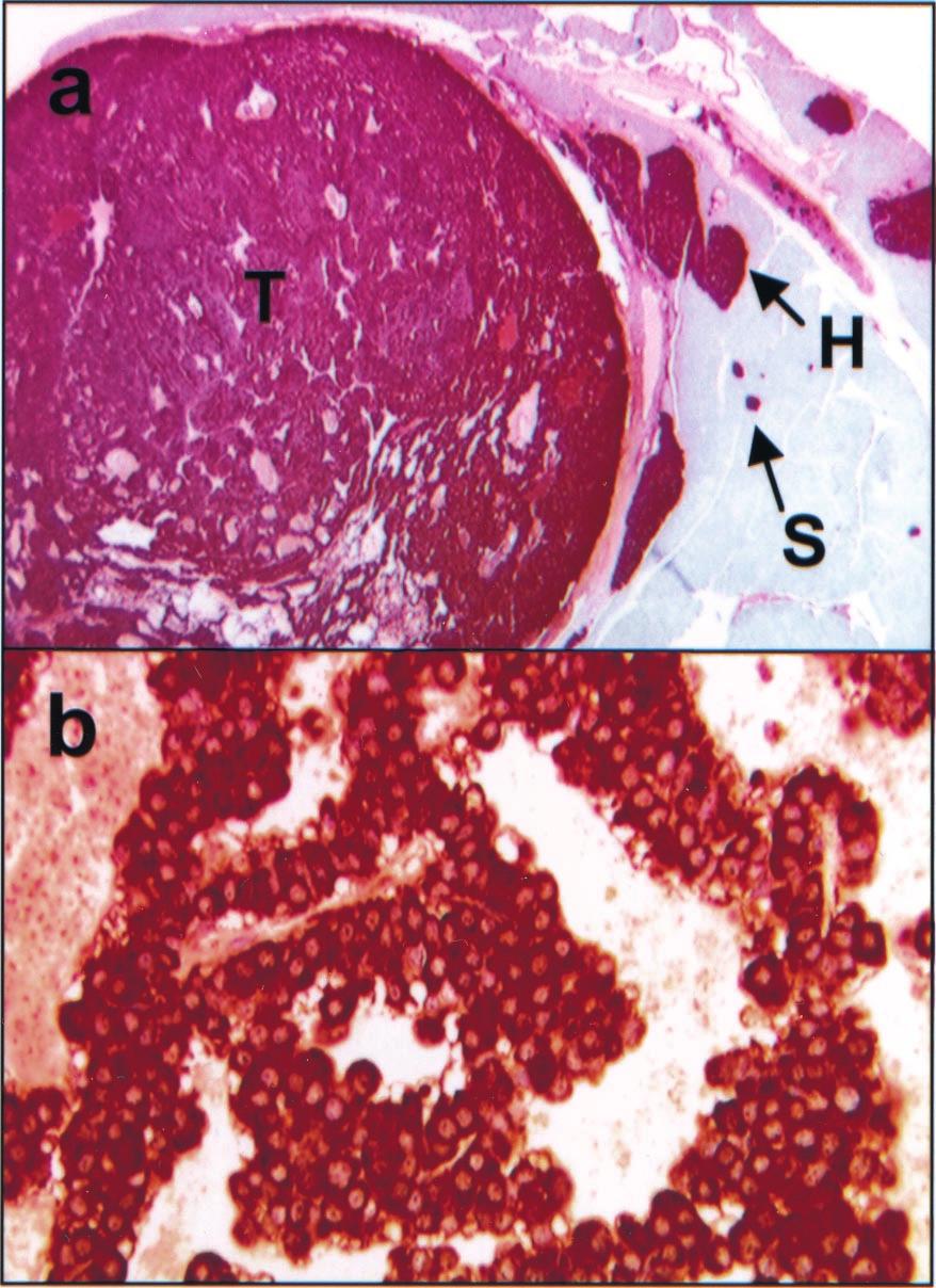 Fig. 4. Immunohistochemistry of Men1 TSM/ mouse lesions. (a) Insulin immunohistochemical staining of a pancreatic section from a 20-month-old mouse.