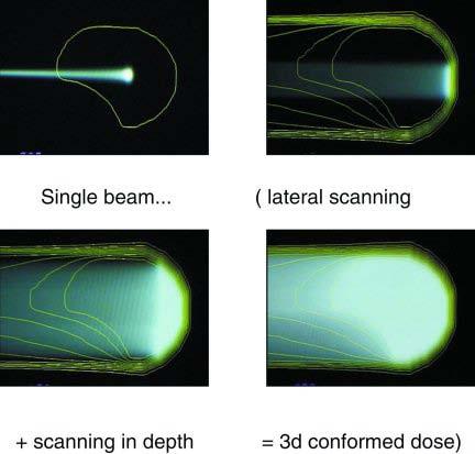 3D Spot scanning techniques Tony Lomax, PSI, Switzerland; note, Leeds/Sydney link/collaboration on robust proton treatment planning Dynamic treatment, requires 3D (and 4D) dosimetry -pencil beam