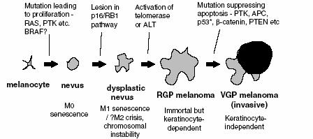 Melanoma is a multi-step process