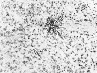 Animal Testing The black star in the middle of the picture shows the tracks made by alpha rays emitted from a particle of pllutonium-239 in the lung tissue of an ape.
