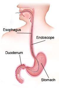 Esophagus Muscular that pushes food into the stomach Stomach Muscular sac churning to breakdown food mechanically & chemically with enzymes Small Intestine (bowels) where