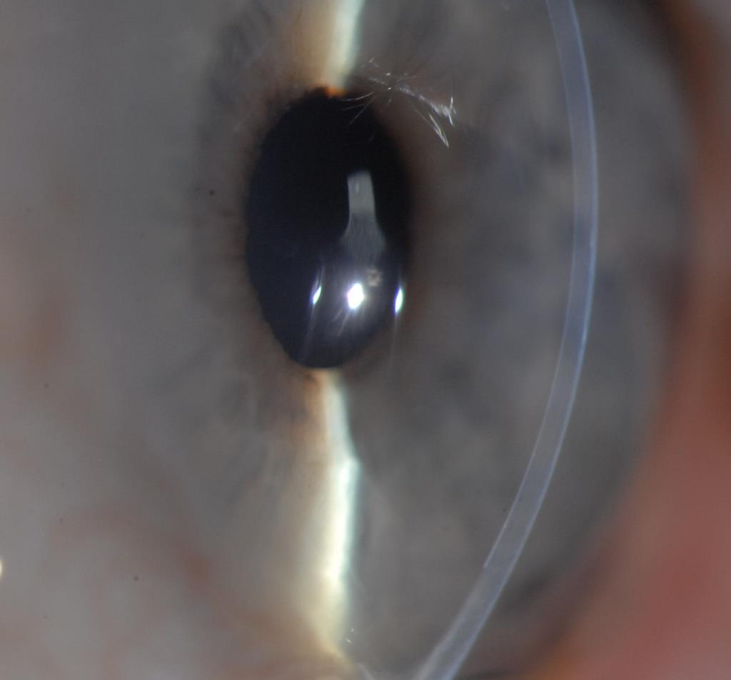 corneal surgeons Minimal costs Potentially: The fastest and most