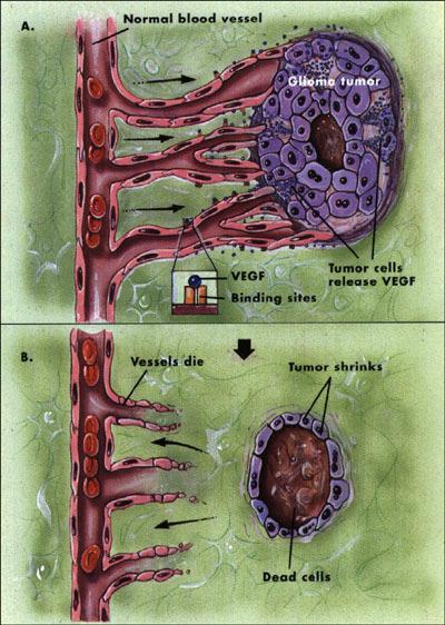 Classification of Tumors Malignant or