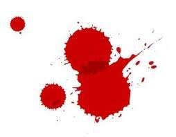 Blood Spatter Analysis - Surface When examining blood spatter, is it important to consider the surface Hard and nonporous surfaces like glass and tile generally result in round drops with less