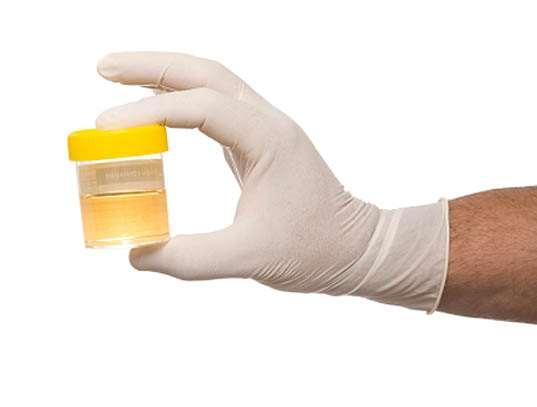 Other Body Fluids: Urine Urine is composed mostly of water, and also includes urea (nitrogenous compound) and salts.