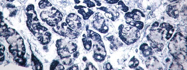 as primary antibody Parietal cells stain