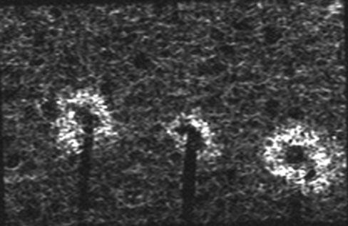 Fig. 5. Magnetic resonance imaging (MRI) of a single slice of the sponge in Figure 4, obtained after 20 min of aerosol administration.