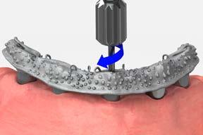 full-arch restorations Multi-unit abutment hybrid or fixed-detachable screw-retained restoration 15 Lab step - Divest, finish, and polish the framework Divest the frame.