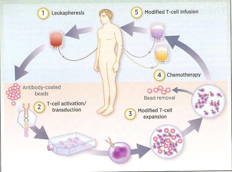 Adoptive T-cell Transfer