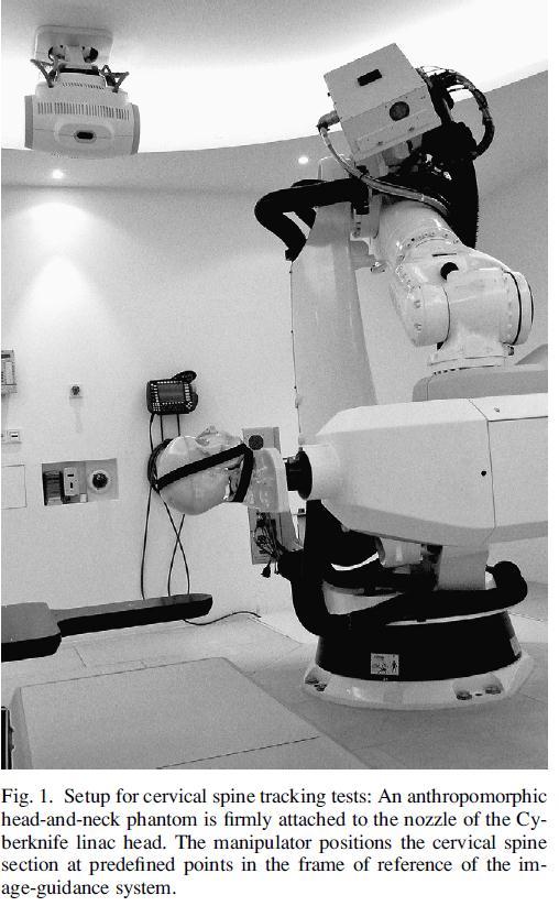 Spine Localization Accuracy Fürweger, C., C. Drexler, et al. (2010). "Patient Motion and Targeting Accuracy in Robotic Spinal Radiosurgery: 260 Single- Fraction Fiducial-Free Cases.