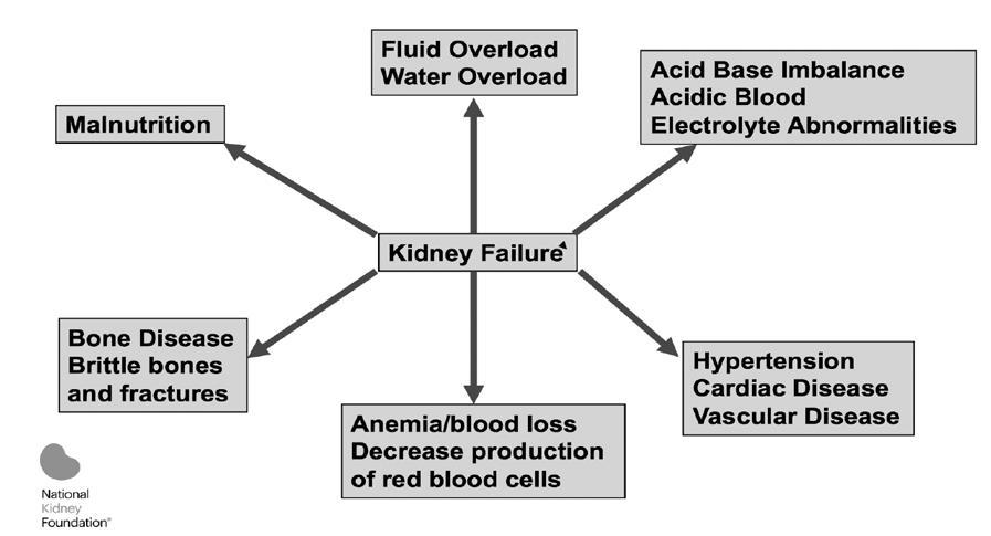 Complications of Kidney Failure