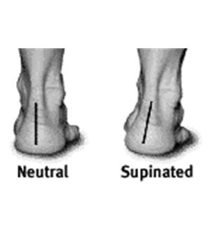 Foot Supination Shorten Muscles: Tibialis anterior Tibialis posterior Medial