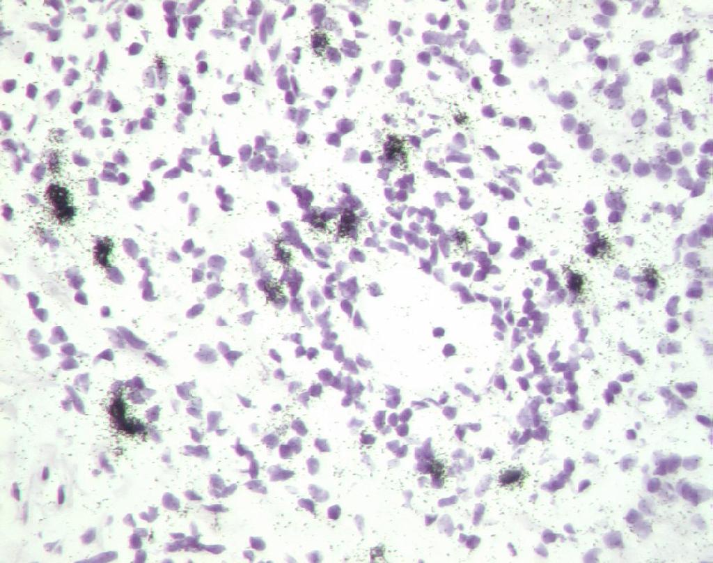 CCR4 mrna+ cells in nasal mucosa Banfield G,