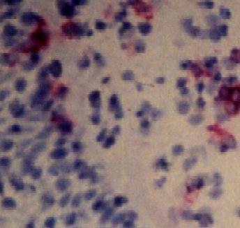 and B lymphocytes CD3