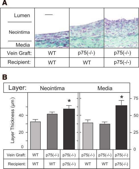 Zhang et al TNFR2 Mitigates Neointimal Hyperplasia 285 recipient mice, in 5 different donor/recipient combinations as follows: (1) /; (2) p75 / /; (3) p75 / /p75 / ; (4) p55 / / ; and (5) p55 / /p55