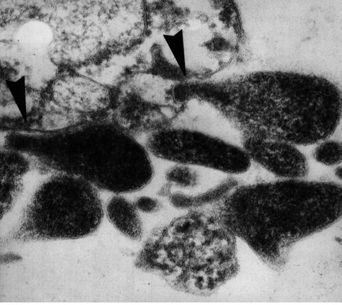 Figure 1. EM micrograph showing M. genitalium adhering to Vero cells with the specialised tip structure (arrow). EM performed by Jens Blom, Statens Serum Institut. 1.4.