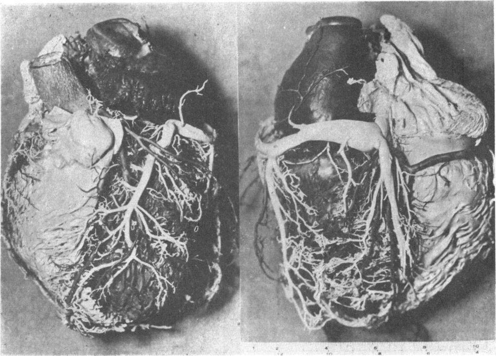 106 William B. Hood FIG. 1.-Example of a finished heart cast. Anterior view of the specimen on the left, and posterior view on the right.