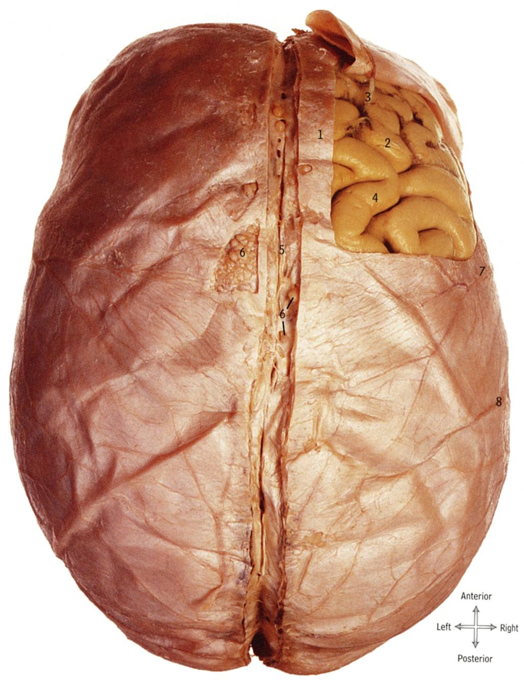 Layers of the Meninges Dura mater (or dura): very dense and tough