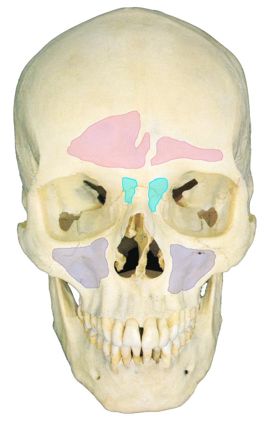 Headaches Sinus headaches: Paranasal sinuses (a.k.a. the sinuses) are air-filled chambers incased in the skull bone.