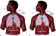 Expiration Respiratory distress 52 53 Respiratory