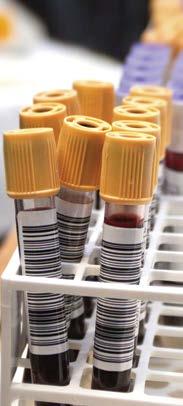 Routine Lab Testing 5 Preliminary Investigations of patients with hypertension 1. Urinalysis 2. Blood chemistry (potassium, sodium and creatinine) 3.