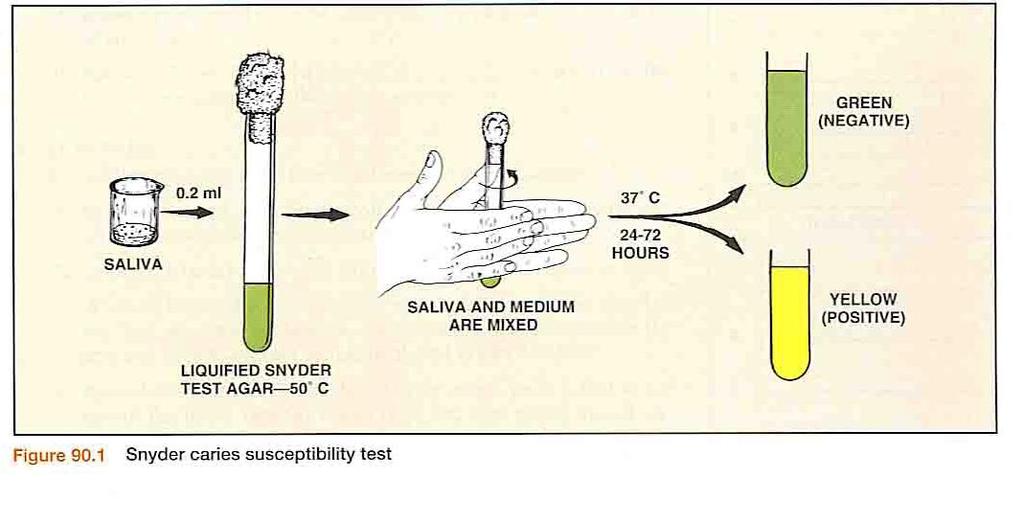 CALORIMETRIC SNYDER TEST [9] Principle involved: Measures the ability of salivary microorganisms to form organic acid from a carbohydrate medium.