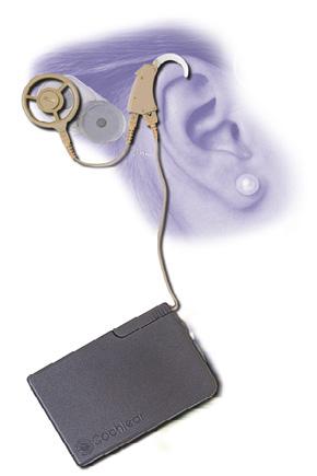 Older cochlear
