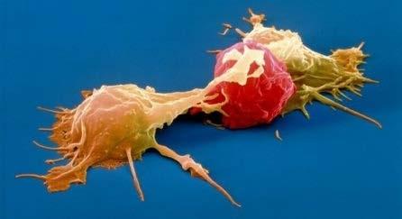cancer cell Macrophage