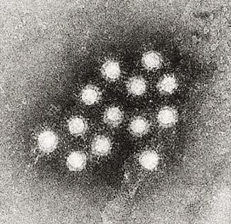 gastroenteritis Low infectious dose Hepatitis A and E Viruses Isosahedral capsid, 25-35