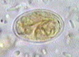 Some Enteric Protozoa and their Diseases Protozoa Disease Amoebas: Entamoeba histolytica