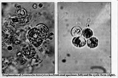 motile, feeding trophozoite (12-50 um) R: Resistant, infective cyst (10-20 um) Giardia