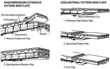 Axial Pattern Supplied